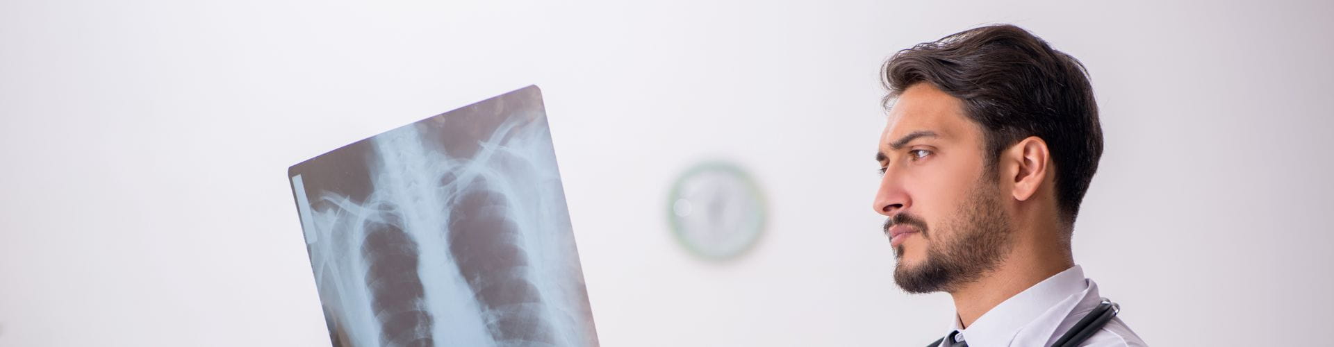 Un jeune médecin examine une radiographie pulmonaire